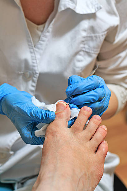 pedicure - podiatry chiropody toenail human foot zdjęcia i obrazy z banku zdjęć