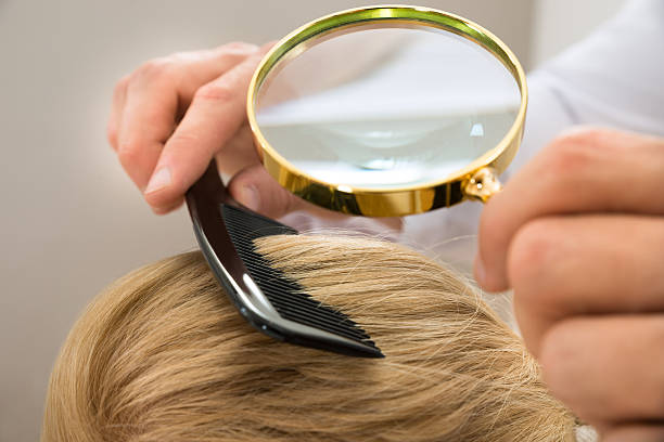 istock Dermatologist Looking Blonde Hair Through Magnifying Glass 521085634