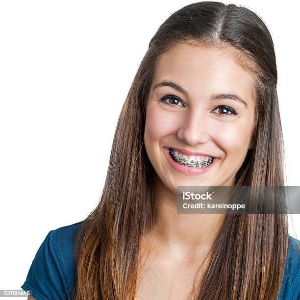 Smiling Teen Girl Showing Dental Braces Stock Photo - Download Image Now - Dental Braces, Teenager, Teenage Girls