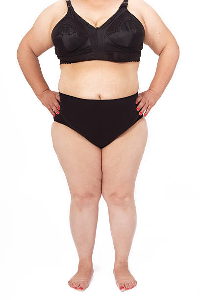 istock Overweight woman body with underwear 521201824