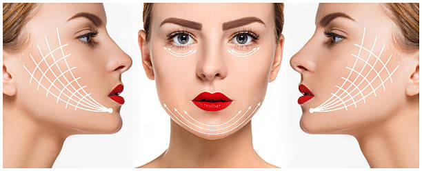 istock The young female face. Antiaging and thread lifting concept 521232088