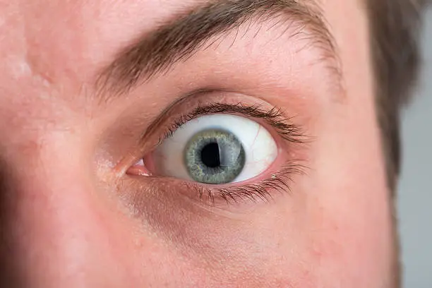 Photo of Surprised man