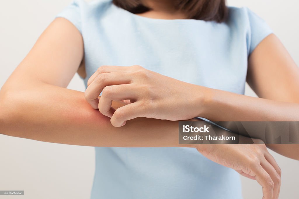 Itching Itching In A Woman Scratching Stock Photo
