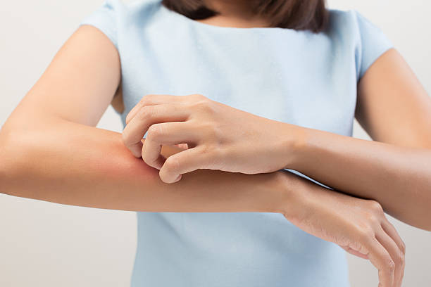 Itching Itching In A Woman dermatitis photos stock pictures, royalty-free photos & images