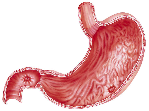 Stomach - Peptic Ulcers Shown is a stomach with peptic ulcers. pyloric sphincter stock pictures, royalty-free photos & images