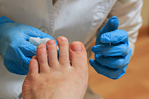 podologia - podiatry chiropody toenail human foot - fotografias e filmes do acervo