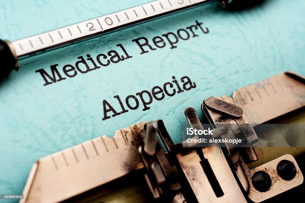 Alopecia Falling Stock Photo