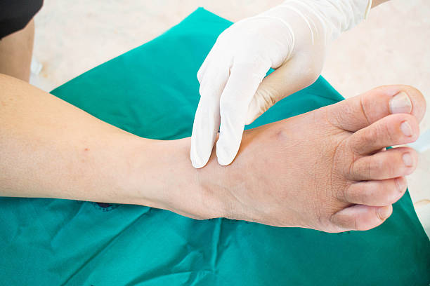 istock diabatic foot skining neuropathy 521853377
