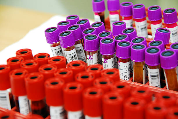 i campioni di sangue a una banca del sangue - antithrombin foto e immagini stock