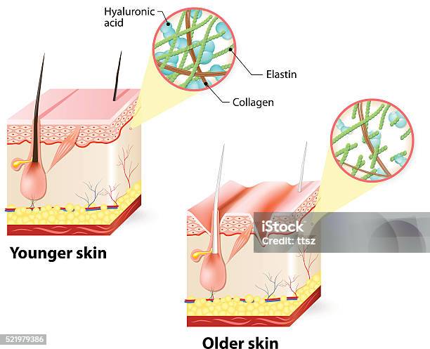 Ilustración de Antigüedad De La Piel y más Vectores Libres de Derechos de Colágeno humano - Colágeno humano, Diagrama, Fibroblasto