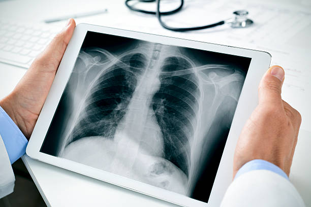 médico observando um baú radiografia em um tablet - human lung x ray image x ray human spine - fotografias e filmes do acervo