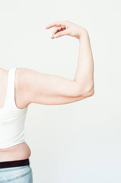 istock Overweight woman, loose upper arm 522386178