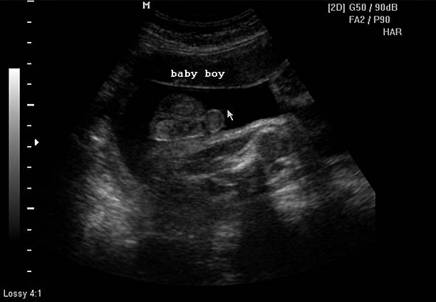 istock Fetus baby ultrasound screen capture 522602237