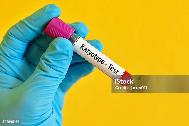 Karyotype Testing Stock Photo - Download Image Now - Biology, Blood, Blood Collection Tube