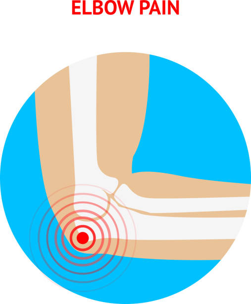 肘の痛みを解消します。肘の痛みアイコンに隔てられた白の背景ます。 - human muscle the human body people muscular build点のイラスト素材／クリップアート素材／マンガ素材／アイコン素材