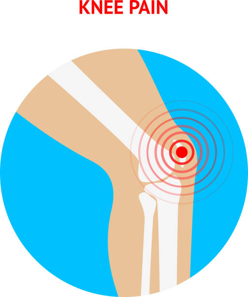 膝の痛みを解消します。膝の痛みアイコンに隔てられた白の背景ます。 - human muscle the human body people muscular build点のイラスト素材／クリップアート素材／マンガ素材／アイコン素材