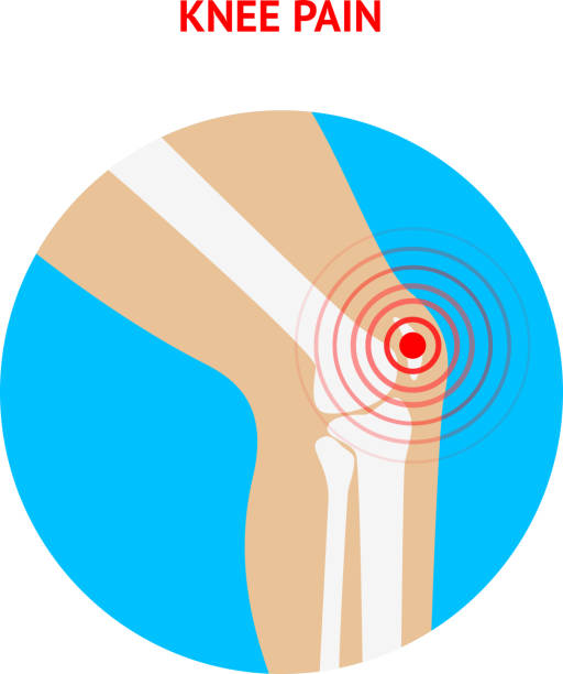 ból kolana. ból kolana ikona odizolowane na białe tło. - human muscle the human body anatomy people stock illustrations