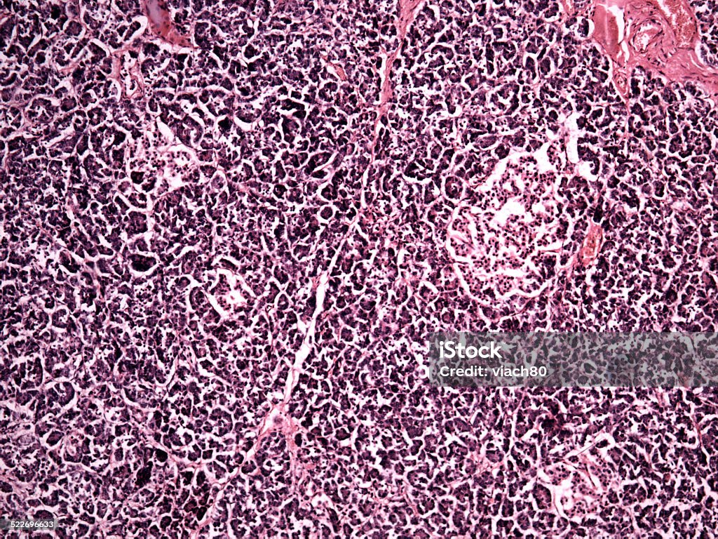 Páncreas de seres humanos - Foto de stock de Anatomía libre de derechos