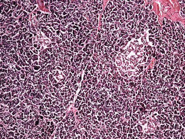istock Pancreas of a human 522696633