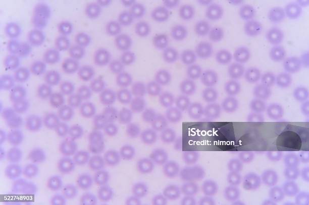 Blood Smear Red Blood Cells Stock Photo - Download Image Now - Analyzing, Animal Blood, Animal Body Part - iStock Blood Smear Red Blood Cells Stock Photo - Download Image Now - Analyzing, Animal Blood, Animal Body Part - iStock