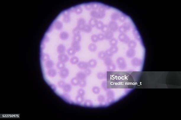 Blood Smear Red Blood Cells Stock Photo - Download Image Now - Analyzing, Animal  Blood, Animal Body Part - iStock