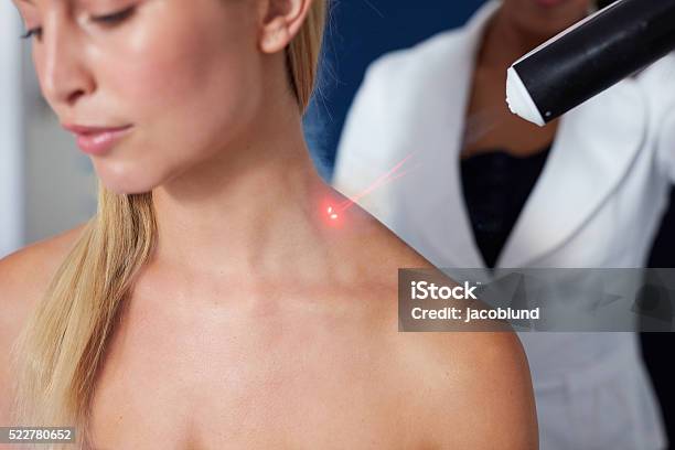 Localized Cryotherapy Session To The Neck Stock Photo - Download Image Now - Medical Laser, Alternative Therapy, Cold Temperature