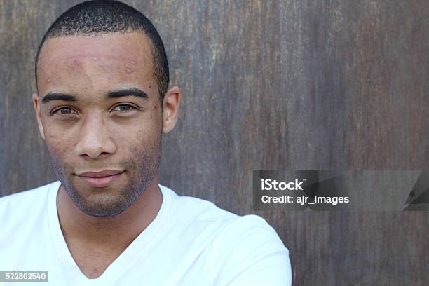Schöne Ethnische Junge Männliche Mit Aknegesichtsbehandlung Stockfoto und mehr Bilder von Akne