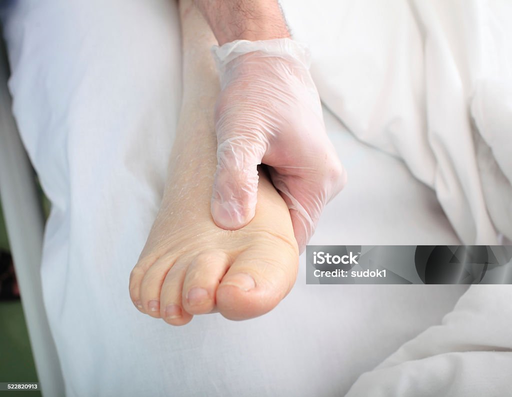 doctor examines foot of heavy patient with edema Edema Stock Photo