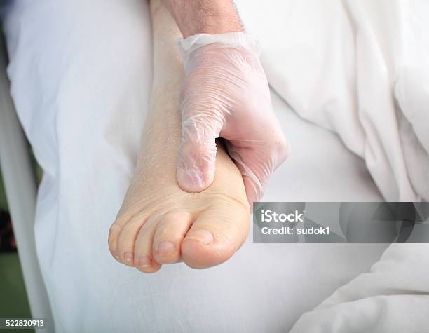 Doctor Examines Foot Of Heavy Patient With Edema Stock Photo - Download Image Now - Edema, Doctor, Senior Adult