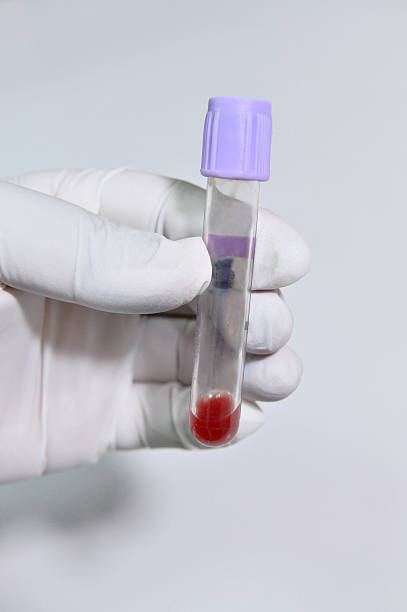 istock Blood test tube in a laboratory 522907525