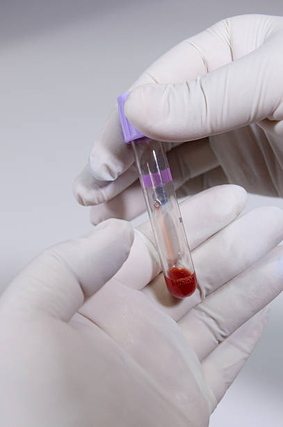 istock Blood test tube in a laboratory 522907527