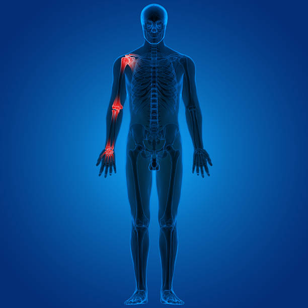 istock Human Body Joint Pains 523157424