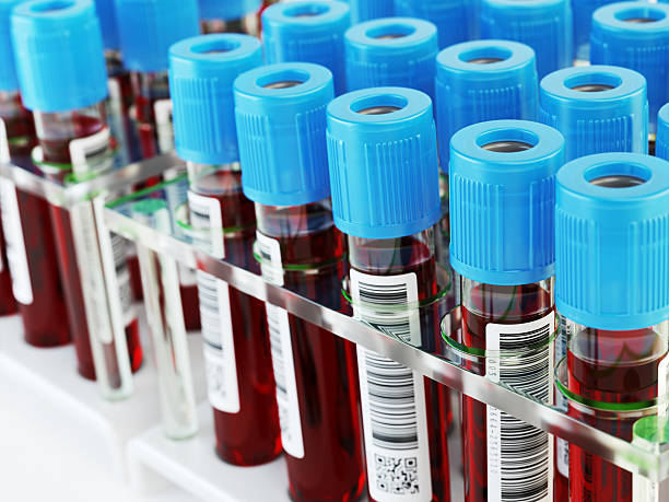 blood test tubes. samples in a rack. - blod bildbanksfoton och bilder