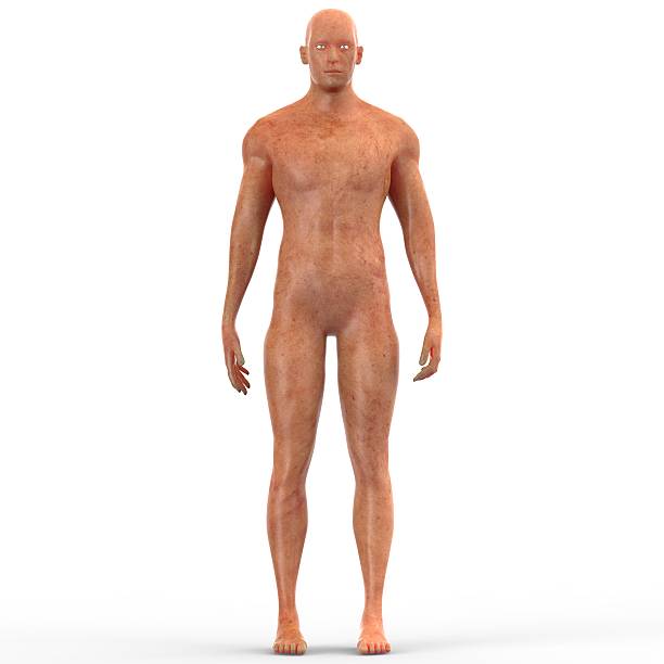 istock Human Muscle Body with Skin Disease 523394508