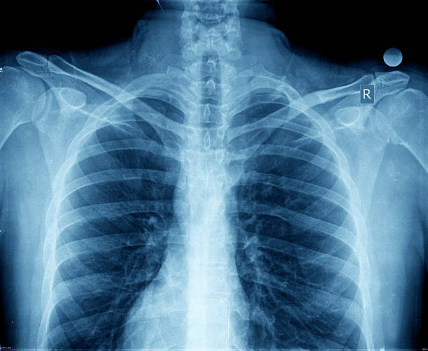рентгенография грудной клетки - healthcare and medicine human heart abdomen human spine стоковые фото и изображения