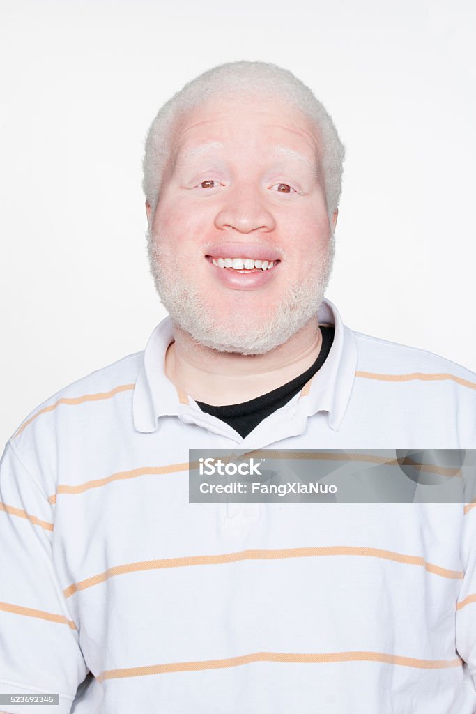 Man smiling at camera Albino Stock Photo