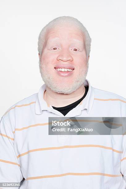 Man Smiling At Camera Stock Photo - Download Image Now - Albino, Portrait, Looking At Camera