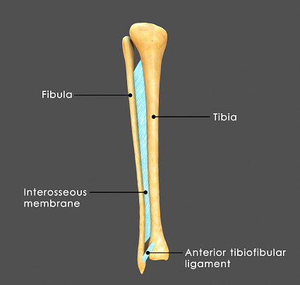 A syndesmosis is a slightly movable joint in which the tibia and fibula are joined together by a connective tissue at the ankle