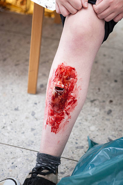Open leg fracture Open leg /shinbone fracture - made up by special effects make-up artists woman legs open stock pictures, royalty-free photos & images