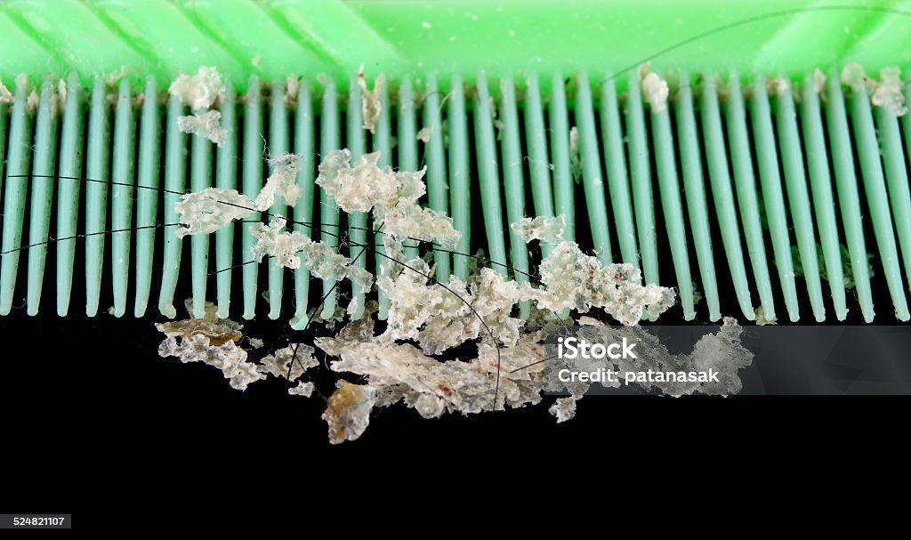 Dandruff and comb Close-up Stock Photo
