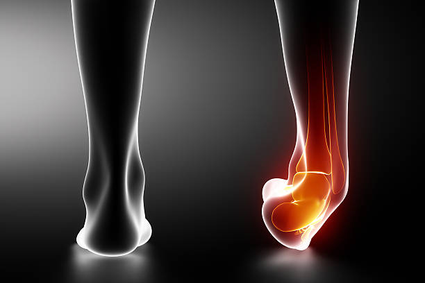 radiografia sprained caviglia nero - ankle foto e immagini stock