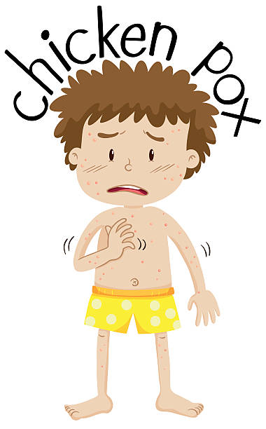 Simple Chickenpox Drawing Clip Art Of Chickenpox Illustrations, Royalty-Free Vector Graphics ...