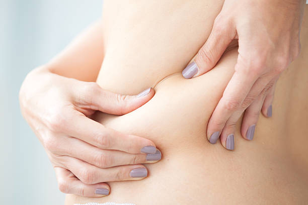 локализованные жира в женщина на спине - adipose cell стоковые фото и изображения
