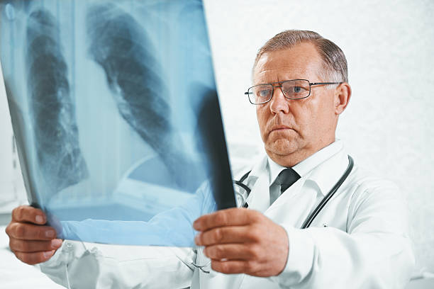istock Senior doctor examines x-ray image of lungs 525125901