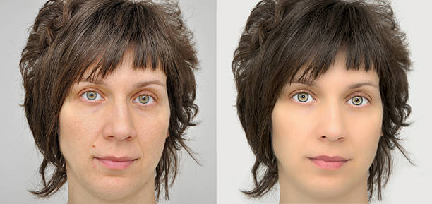 istock Woman before and after applying make-up and computer retouching 525150453