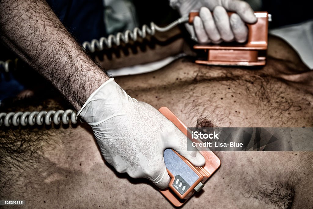 Cardiac Defibrillation Defibrillation during cardiac arrest. Defibrillator Stock Photo