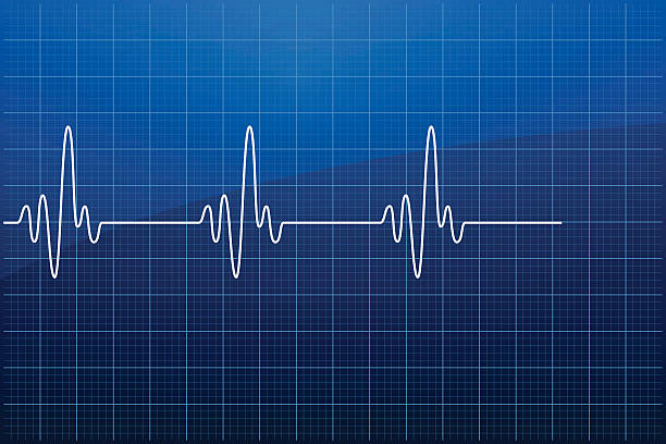 electrocardiogram ekg-vektor - human heart surveillance computer monitor pulse trace stock-grafiken, -clipart, -cartoons und -symbole