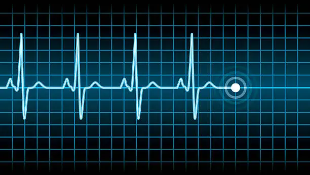 Vector illustration of Heart Beat