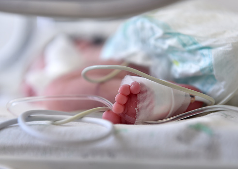 Newborn baby with cannula in the feet on a hospital bed