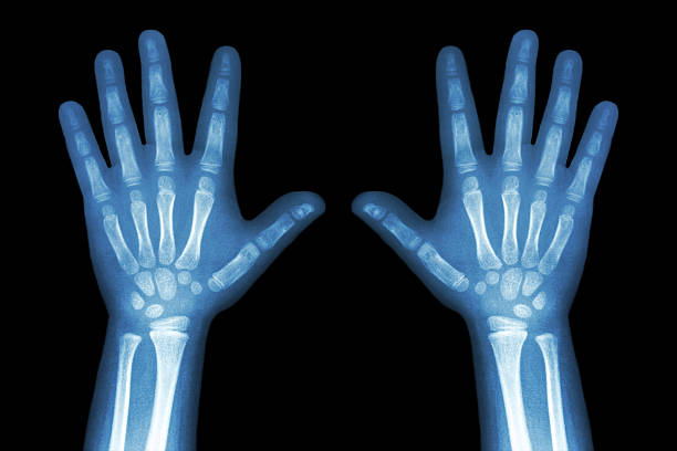 x-ray sowohl kind hände, auf schwarzem hintergrund - x ray x ray image human hand anatomy stock-fotos und bilder